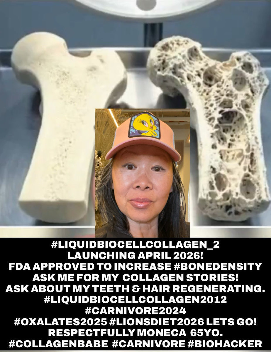 CollagenBabe's tweet image. #HelpHumansHeal #bonedensity is core antennae for energy receiver.  BONE need #collagen glue MATRIX to adhere.  
Been studying #liquidbiocellcollagen2012  #Carnivore2024 #oxalates2025 #LionsDiet2026 
LETS GO! 
Respectfully Moneca #CollagenBabe  #Carnivore #Biohacker 🙏🧠❤️🥩🇨🇦✨