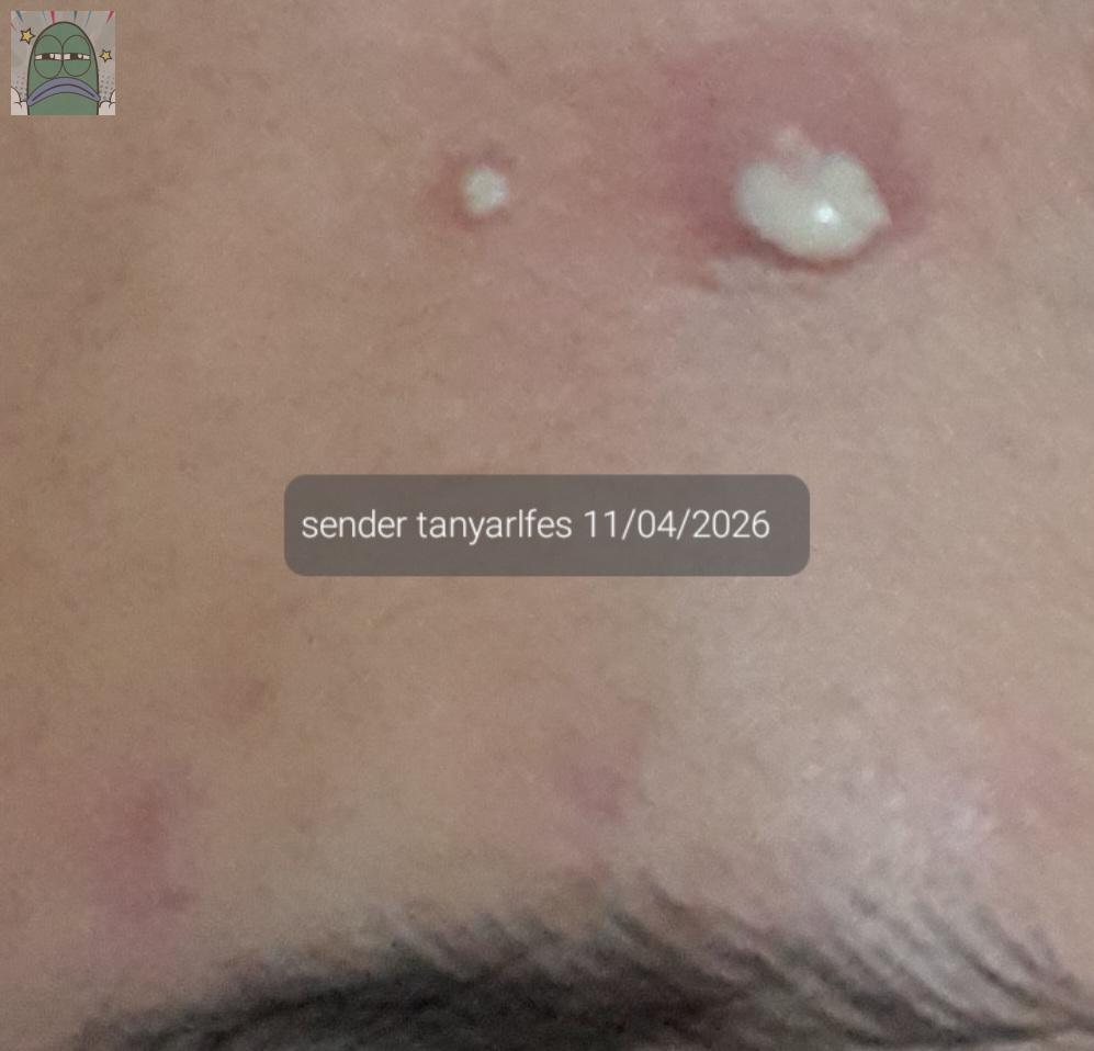 Tanyarlfes tweet media