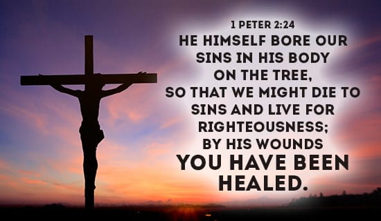 Christ lived a sinless life. The sins that He bore on the cross were ours. He took our punishment upon Himself so that we might be reconciled back to God, acquitted of our sins &amp; covered in His righteousness! #cityonahillnashville tinyurl.com/4r7khb4e