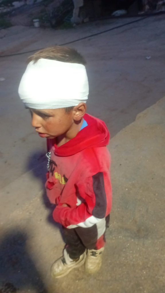 AbujomaaGaza's tweet photo. Palestinian boy has been wounded by Israeli zionist jewish settlers in Masafer Yatta, the occupied West Bank.. https://t.co/xhXMhGbHSF