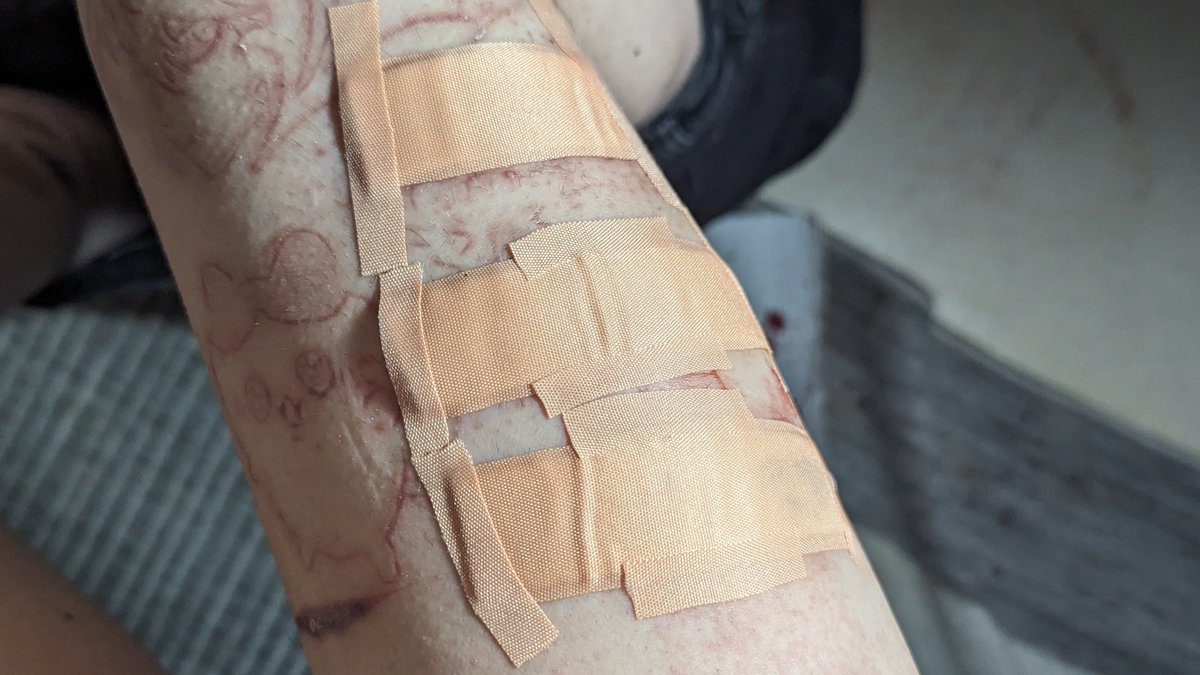 Tillytilly tweet media