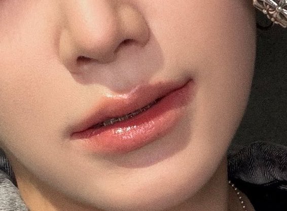 samidcre's tweet photo. YUM BRACES NOBODY MOVEEEE https://t.co/pQLnMksEYC
