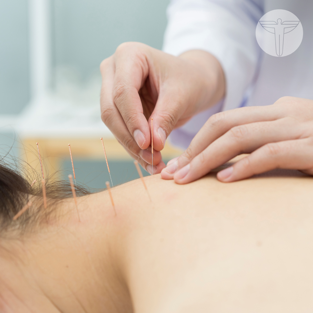 SouthOrangeChi1's tweet image. Feeling tired or sluggish? Acupuncture can give you a natural energy boost. 

If you’re looking for a way to feel more energized and improve your health, acupuncture could be a helpful option.

Discover more: bit.ly/4hMMdcp

#southorange
#wellness
#acupunture