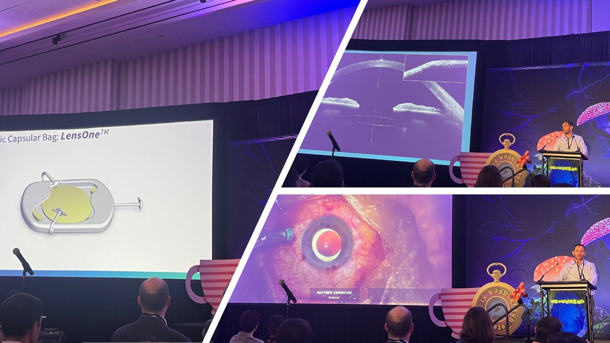 RetinaToday's tweet image. Frank L. Brodie, MD, MBA, shared a very cool prosthetic capsular bag that can be scleral fixated. The surgery takes about 5 minutes, he said. @VitBuckleSoc @YoungMDConnect #VBSinWonderland #retina