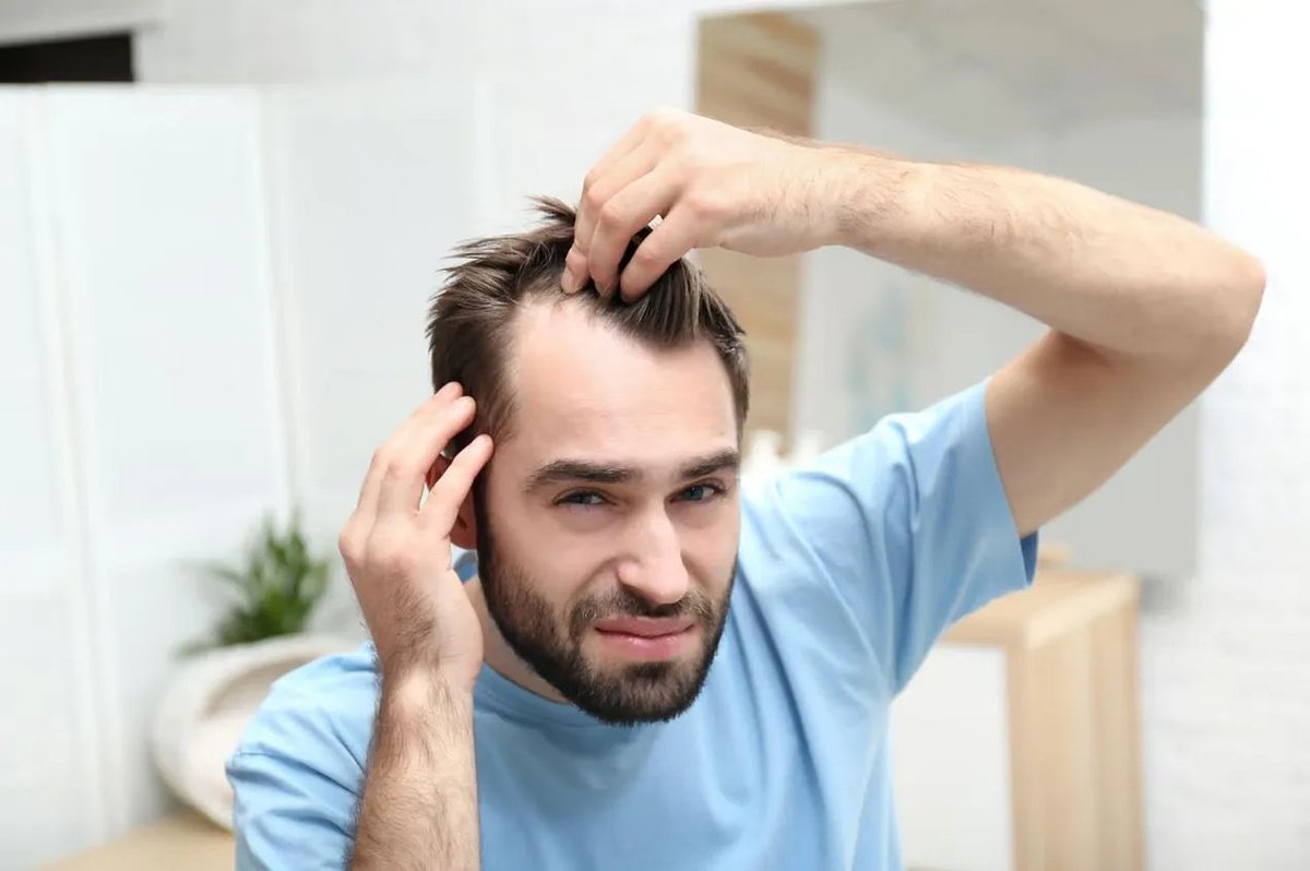 questmoosa's tweet image. If you are suffering from alopecia on the head, rather than spending $9997 on hair transplants, it would be a smart idea to check gut health and FIX LEAKY GUT!

Leaky gut is really a big issue. 

It allows toxic particles in the gut to enter the body that shouldn’t be able to.