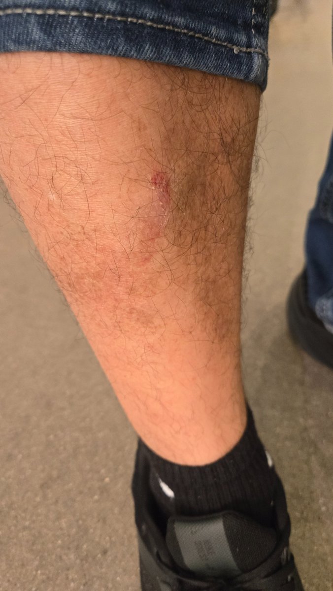 StephenJardim's tweet photo. @Wegmans safety hazard here. I hit my shin in this. At the store in Whippany. https://t.co/RzAPFHZB6f