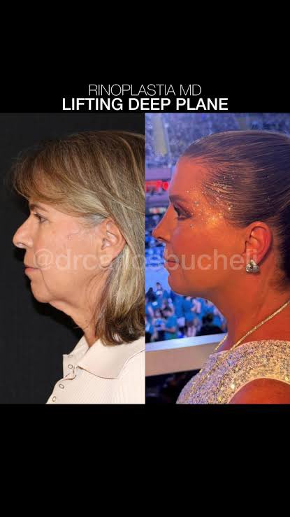 🧛🏻‍♀️ Vampira safada brilhando pra caralho tweet media