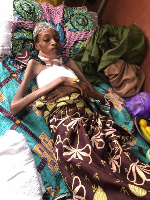 bb_khamees's tweet photo. A young woman, Bilkisu Shehu, is currently battling a serious chronic skin condition and urgently needs medical treatment. 💔

According to her medical report, she requires ₦300,000 for proper care and management of her condition.

No one deserves to suffer when help is possible. 🙏  
We are appealing to everyone—friends, family, and kind-hearted individuals—to please support her in any way you can. Every contribution, no matter how small, will go a long way in helping her get the treatment she needs.

Donation Details:  
Account Name: Fatima Muhammad 
Account Number:  0011289636
Bank Name: jaiz bank

For transparency or further information, call :08060067788/08035578014
please send a DM.

Let’s come together and save a life. 🤲

#SaveABilkisu #HelpSaveALife