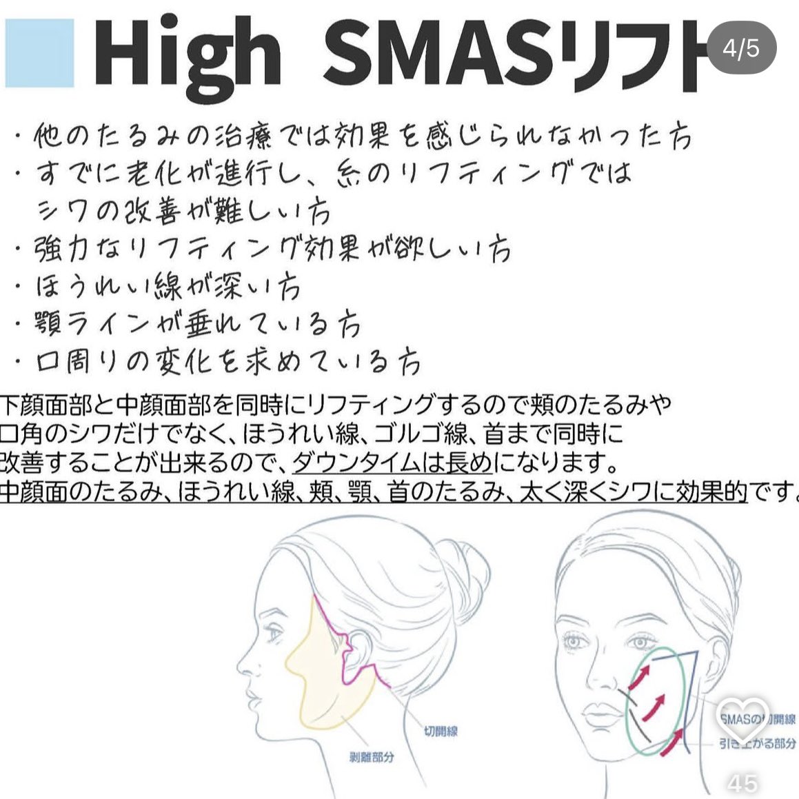 すずちゃん🫧 tweet media