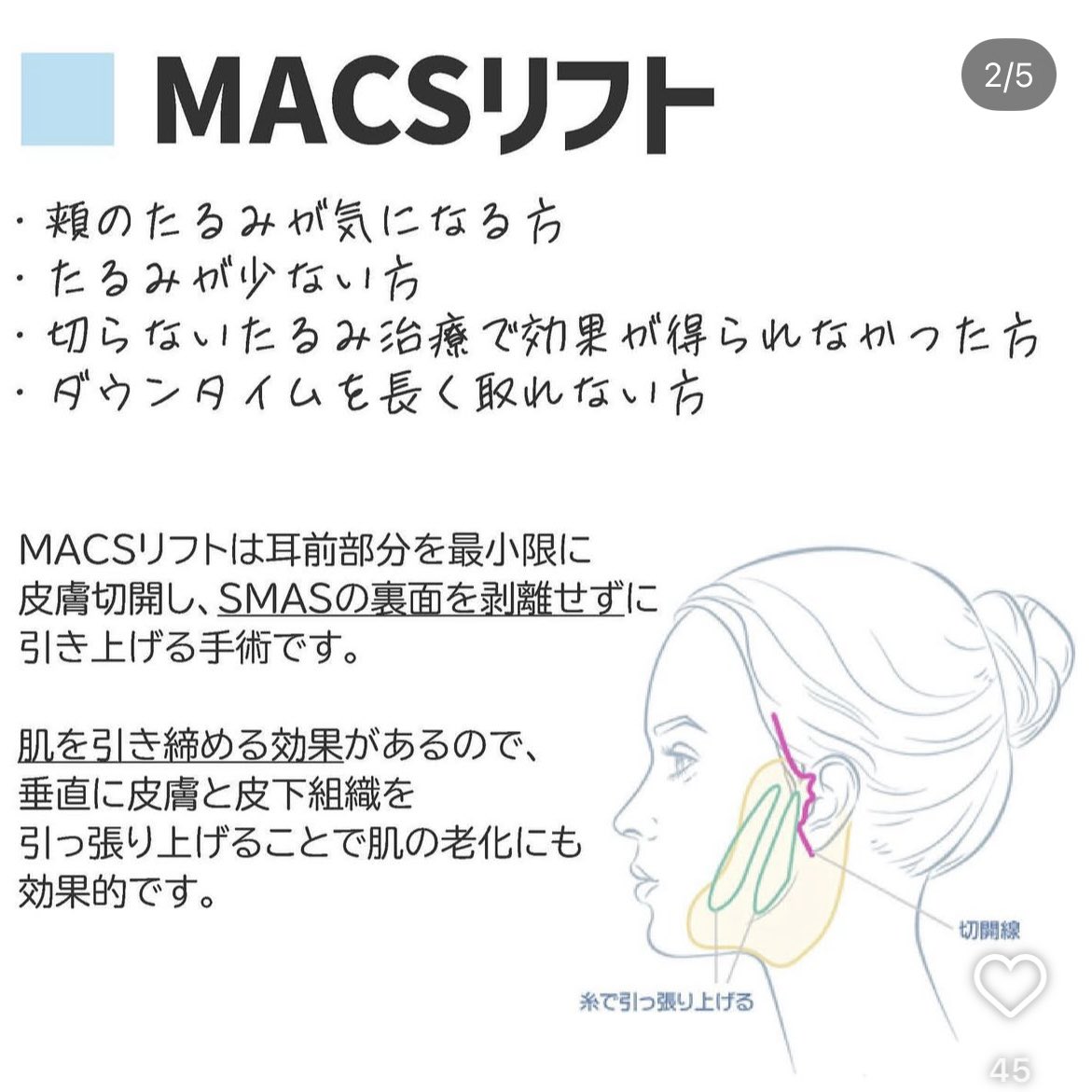 すずちゃん🫧 tweet media