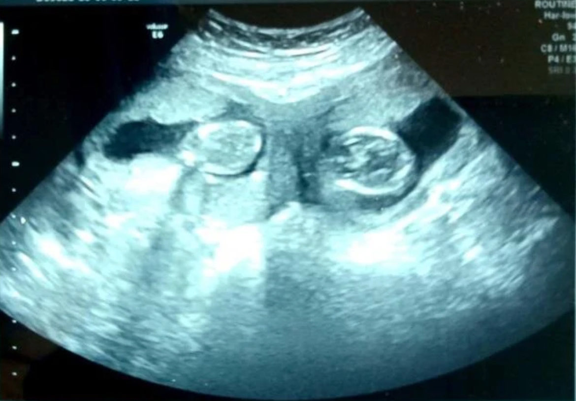 ponding👀🇱🇧 tweet media