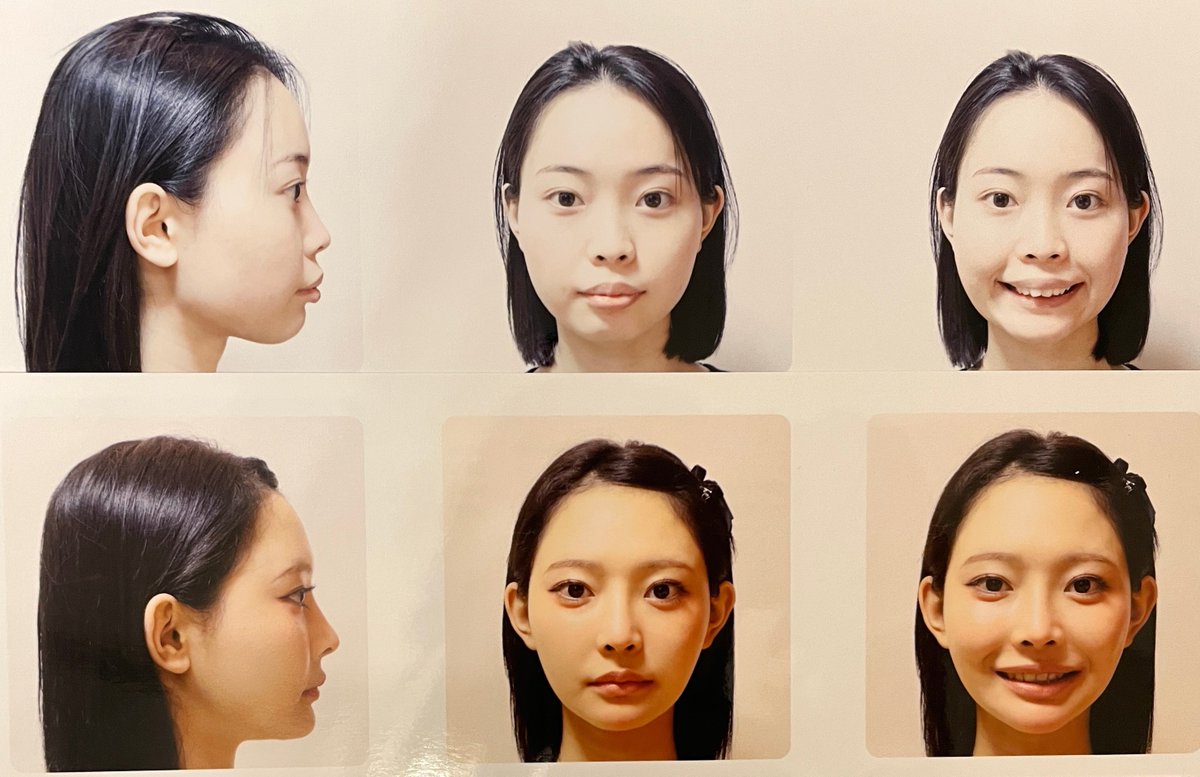 ケロちゃん tweet media