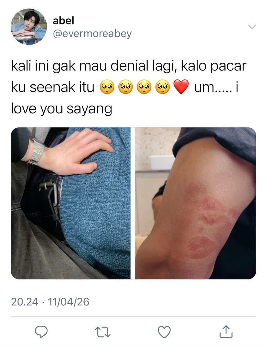 jakeuitb's tweet photo. #sungjake one tweet au, from sayaka abel.

semakin hari pengelihatan semakin cabul https://t.co/qbTSNNtevt