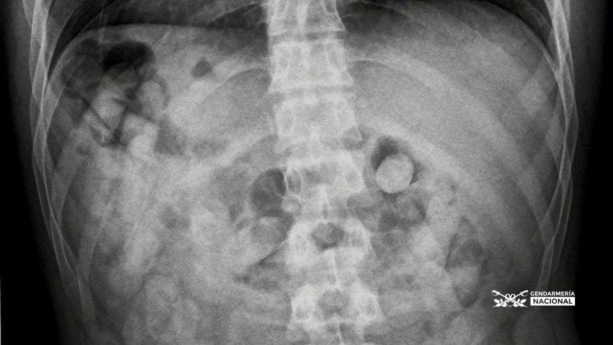 Gendarmería Nacional tweet media