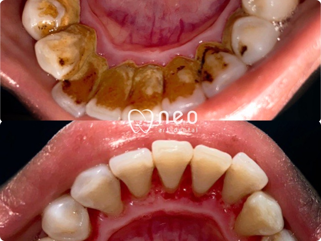 Unpadfess tweet media