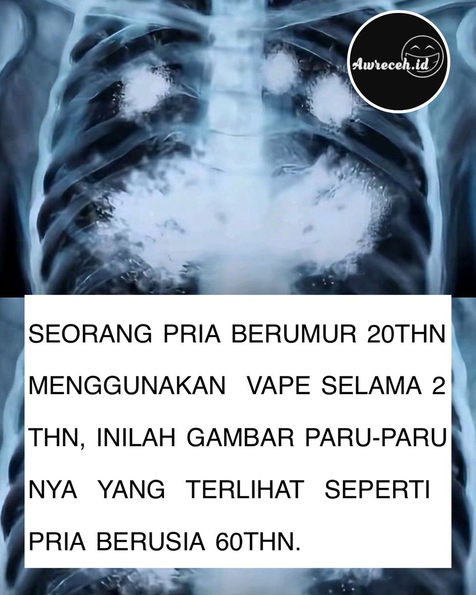sosmed keras tweet media