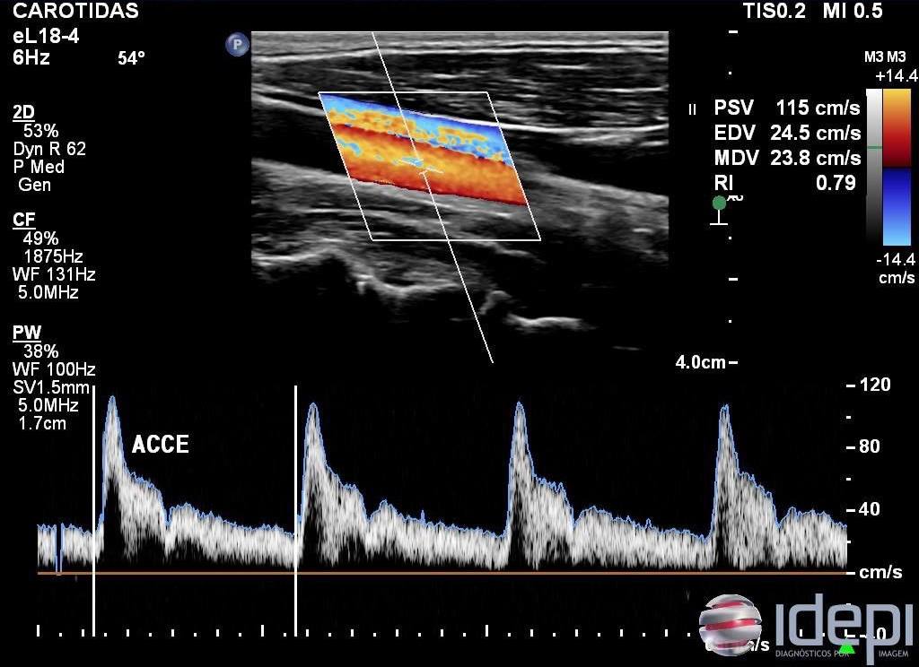@levelsio tweet media