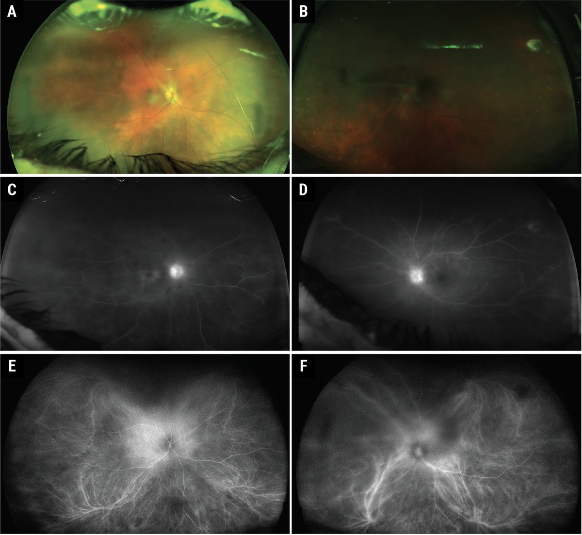 Review of Ophthalmology tweet media
