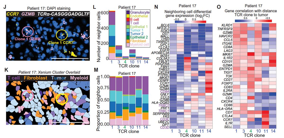 EricTopol's tweet photo. Towards Spatial Medicine for individualized cancer immunotherapy @SciImmunology 
"The convergence of spatial biology platforms, single-cell immune profiling, and machine learning is positioning the community to decode how T cell immunity is spatially organized in human tissues and to
exploit that organization therapeutically"
https://t.co/tYaEyusANy
https://t.co/AHvBzGQE2e