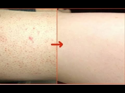 مسوقة ايهيرب tweet media