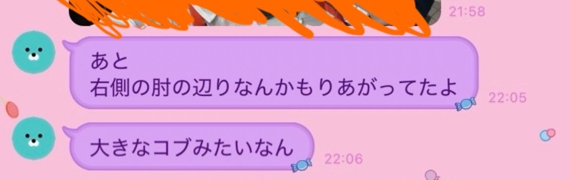 最前でわたしのガングリオンを見つけてくるままりーた