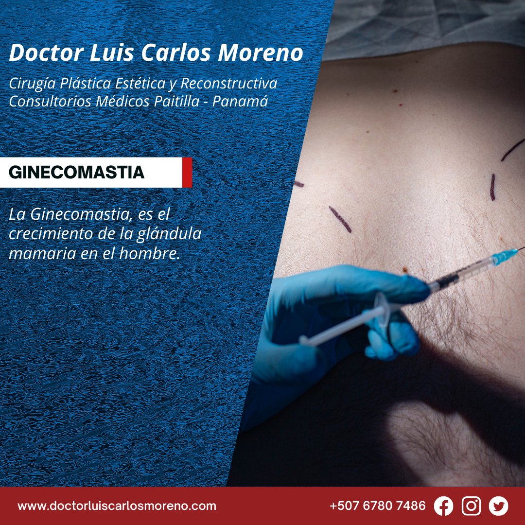 📅 ¡Agenda tu Cita! 🔗 MSN Doctor: msndoctor.com/doctor-luis-ca…
🌐 Web: doctorluiscarlosmoreno.com/ginecomastia
📞 Contáctanos: ☎️ +507 6575-6493
#Ginecomastia #CirugíaPlástica #SaludMasculina