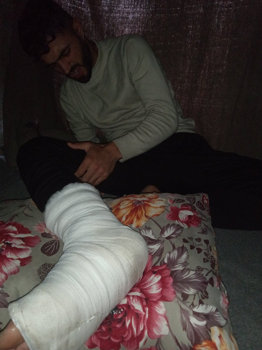 I never imagined I'd reach this point…

I left the hospital after making sure my daughter was okay, and went to find something simple to feed my family… But in a single moment, everything changed. A car hit me, leaving me with a broken leg and completely disabled.

Today… I