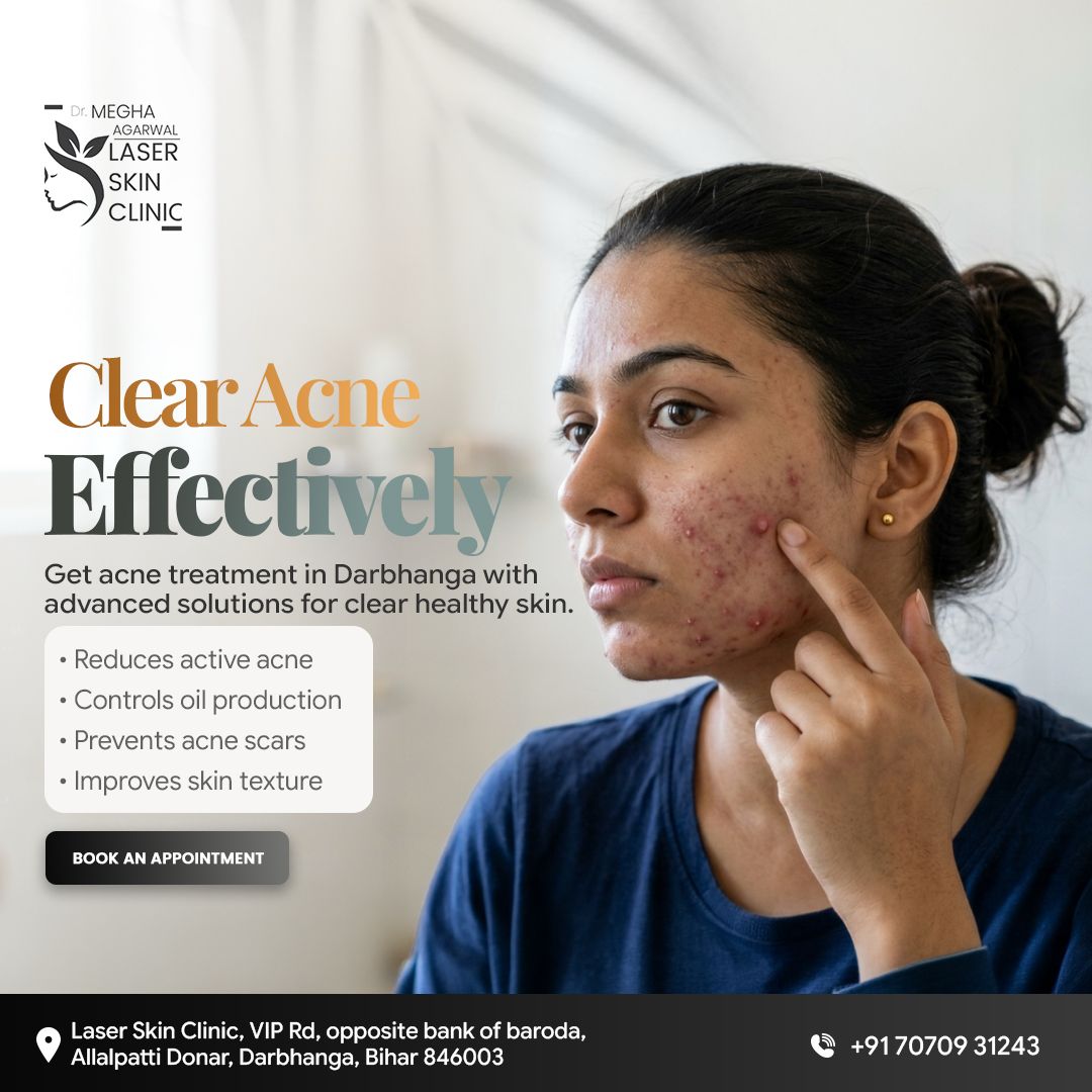 laserskincldbg's tweet image. Tired of acne? We've got the solution!

Advanced Acne Treatment in Darbhanga!
🔴 Reduces Acne
🛡️ Prevents Scars
✨ Better Skin Texture

📞 +91 70709 31243
🌐 laserskinclinicdarbhanga.com

#AcneTreatment #ClearSkin #Darbhanga