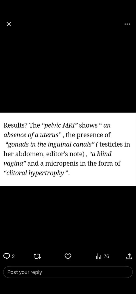 Chris Davis tweet media