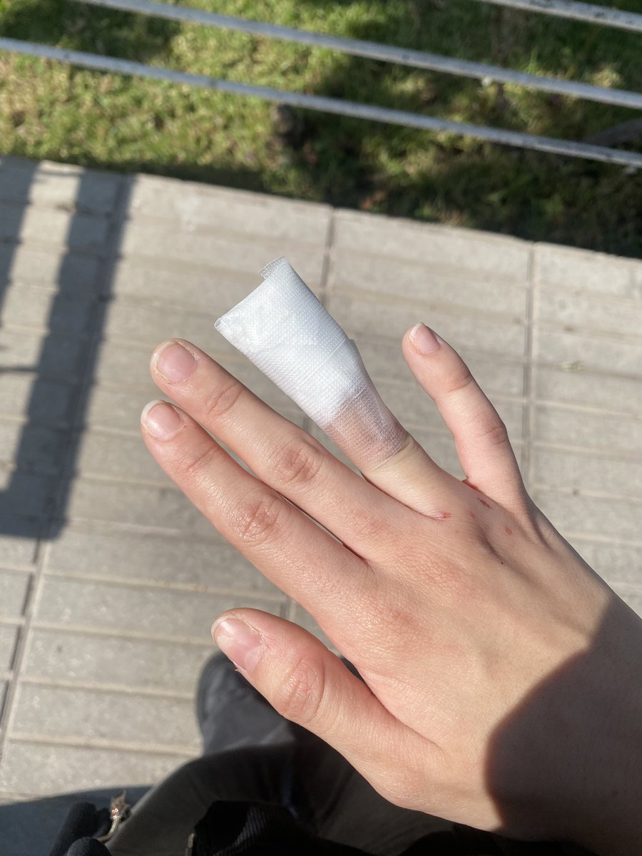 moraleja, nunca se saquen los cueritos de los dedos o van a quedar cmo yo !!