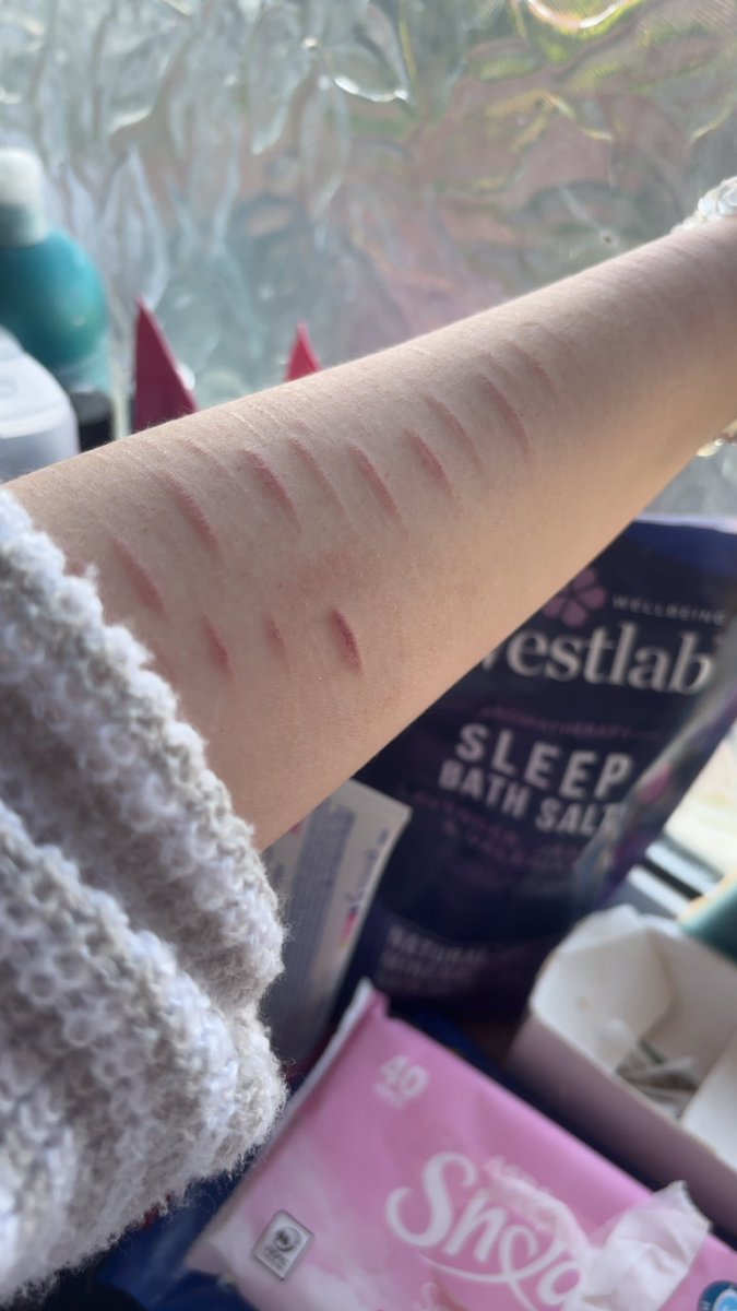 Lilaec_'s tweet photo. Scar check!! Sfx all fake 😊 #shtwt https://t.co/EcqNLQEWgp