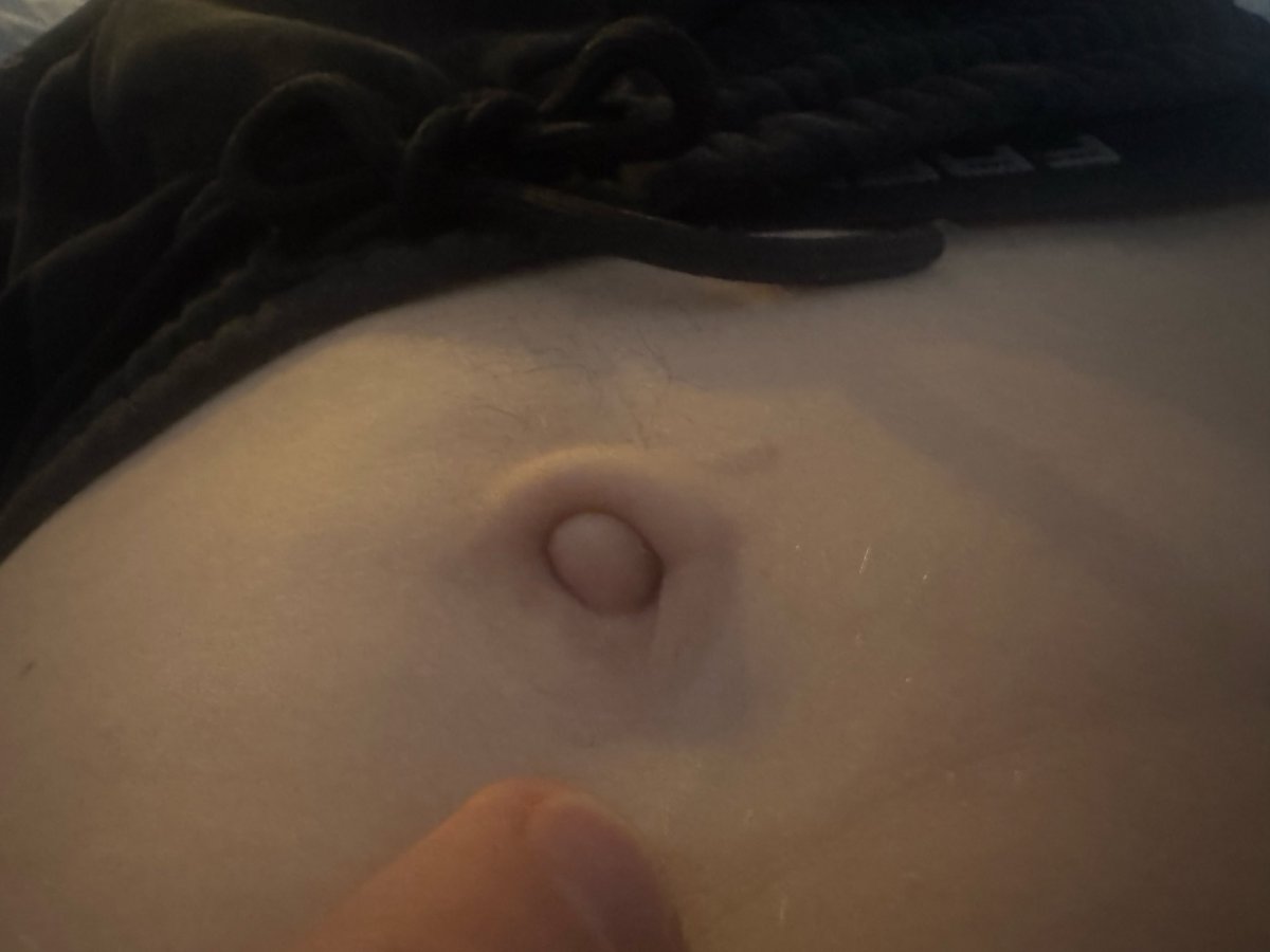 Jim Koopar tweet media