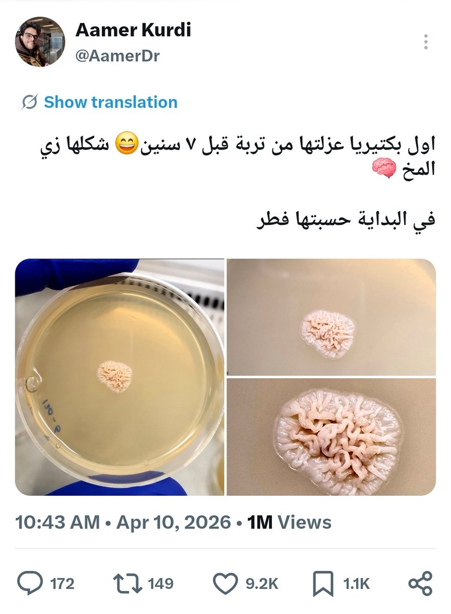 ما اتوقعت بتوصل مليون مشاهدة في اقل من يوم😅 

تخصصي بعيد عن البكتيريا بس راح ابحث عنها ان شاءالله واعطيكم تفاصيل البكتيريا دي🦠
