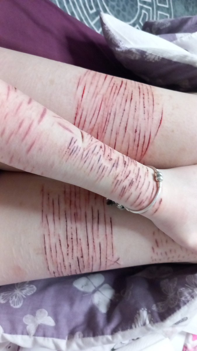 𝒀𝒖𝒓𝒊 𝒐𝒇 𝑺𝒉𝑬𝒅𝑻𝑾𝑻 tweet media