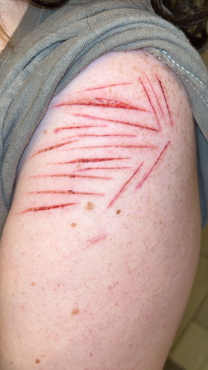 rainbowdash of shedtwt tweet media