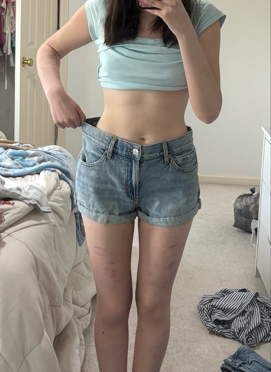 icecreamcat23's tweet image. i love losing weight #edtwt #weightloss