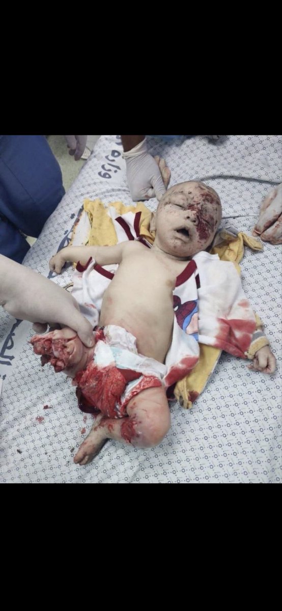 Aziz91499781's tweet photo. @AFRICANDEMOC Israel killing babies !!! https://t.co/nuNY58AfXt