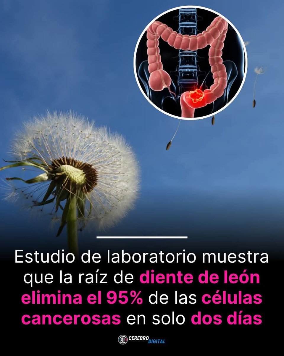 destapandolose1's tweet photo. ÚLTIMA HORA: Estudios de laboratorio han demostrado que la raíz de diente de león puede destruir hasta el 95% de las células cancerosas en tan solo DOS días.🎯 https://t.co/vOpsirmrGG