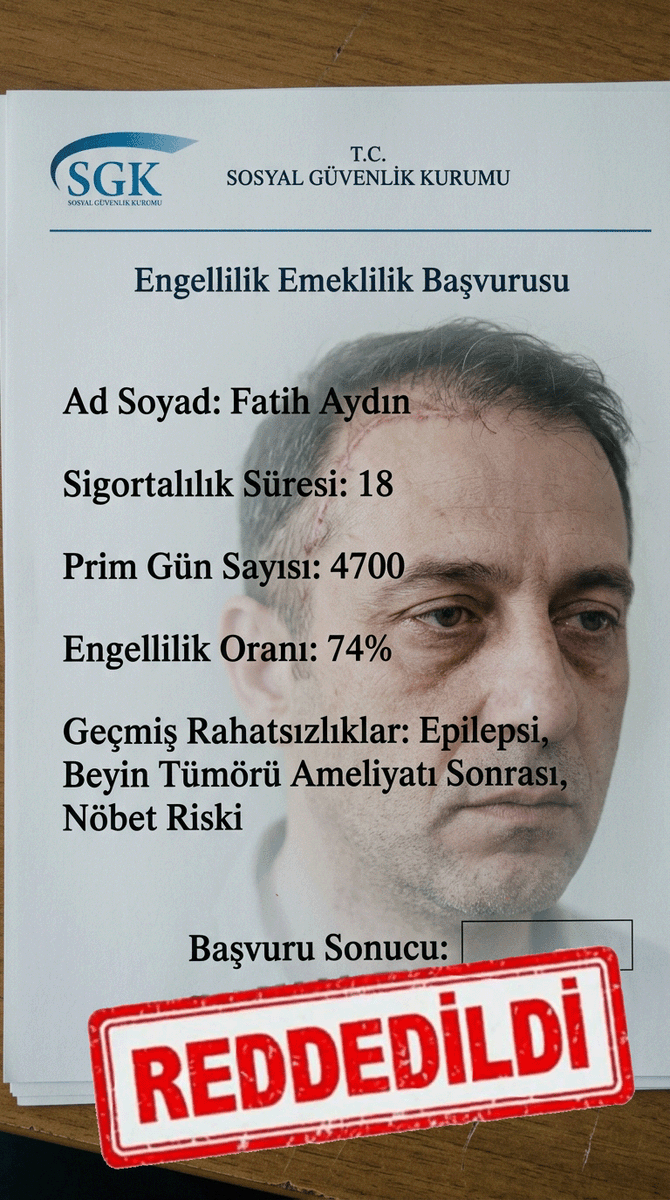 NaezLi's tweet photo. Beyin ameliyatı geçirmiş, denge kaybı ve bilişsel yorgunlukla boğuşan bir insanın "oran" hesaplarıyla emekliliğini iptal ediyorsunuz! 
Sayın @AYMBASKANLIGI, kafatasında dikiş izi, ruhunda ameliyatın yükü olan bu insanlar 60 yaşına kadar nasıl çalışsın? 
#suçumuzneki #KAYvFB #KYSvFB 
Ölelim mi?