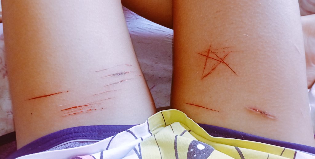 Sayowill_'s tweet image. Cutee

⚠️ All makeup/sfx !!

#scarstwt #shtwt #988twt