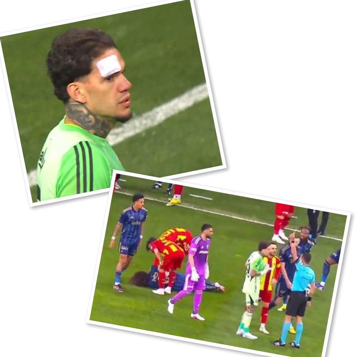 Fenerbahçe Spor Kulübü’nün değerli başkanı ve yöneticileri;

❗️Ederson’un atılan yabancı madde ile kaşı açılmış;hakem neden anons 📢 yaptırt(a)mıyor?

❗️Fenerbahçe futbolcusu kafa yedikten sonra 2 (iki) Fenerbahçe futbolcusu sarı kart görüyor;Fenerbahçe kalecisi kaleden çıktı