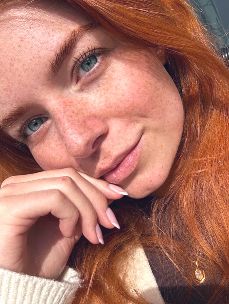 FreckledFace111's tweet image. #FreckledFace 💚#Beauty