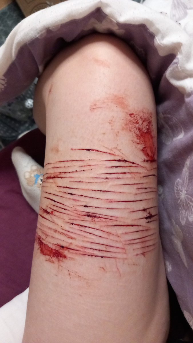 𝒀𝒖𝒓𝒊 𝒐𝒇 𝑺𝒉𝑬𝒅𝑻𝑾𝑻 tweet media