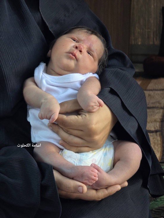Elissamaiss's tweet photo. 🚨🚨🚨🇵🇸Info de dernière minute 

La situation est très grave.🇵🇸🇵🇸

À Gaza, de nombreux enfants naissent avec des malformations congénitales, apparemment en raison des mères inhalant la fumée toxique des missiles, ou d’Israël mettant délibérément des substances toxiques dans l’eau qui affectent les mères !!!
Diffusez un maximum !!!