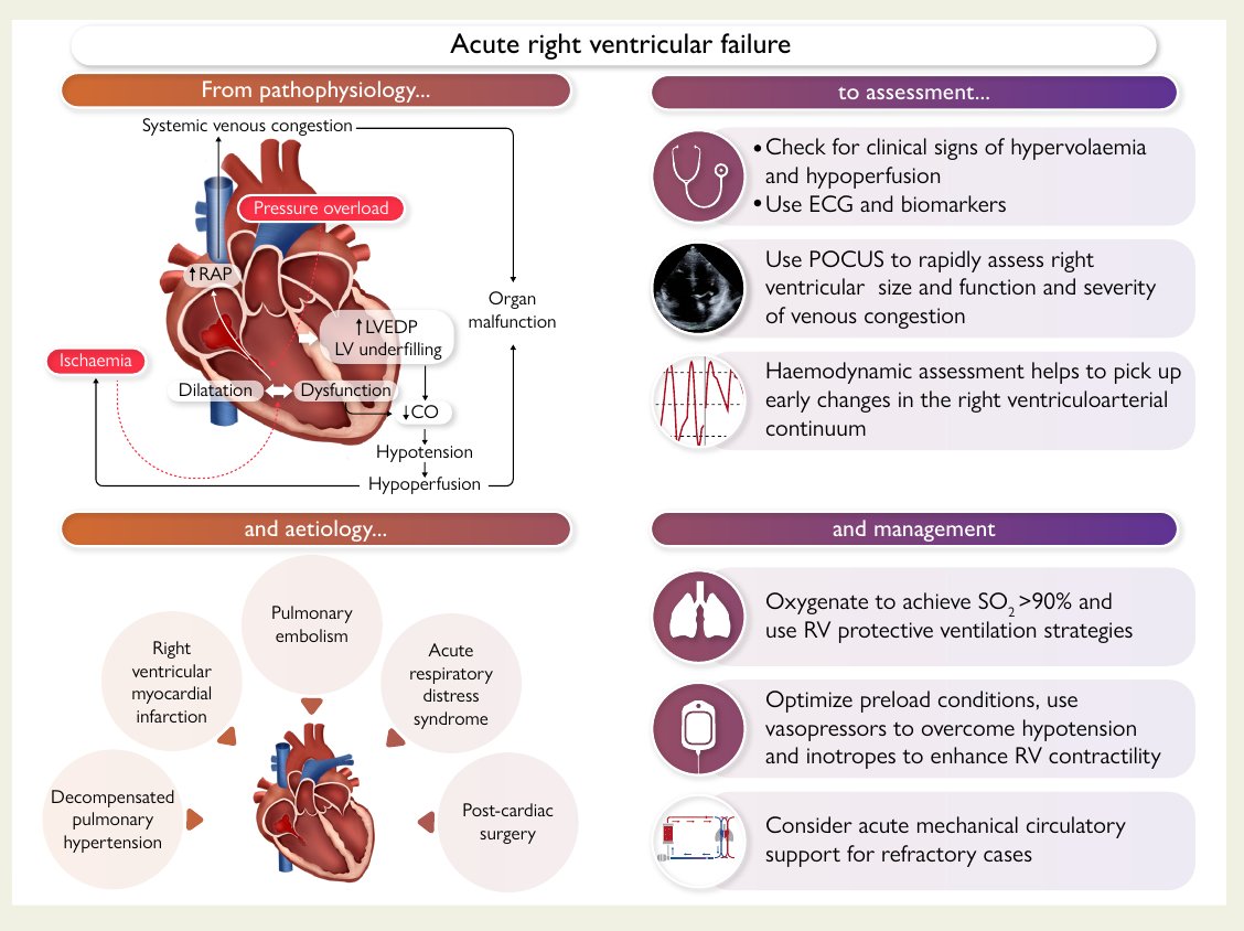 MHcsba's tweet image. ESC 2025: Falla ventricular derecha
 doi.org/10.1093/eurhea…
#MedEd #MedTwitter #MedX
medicina-interna.org