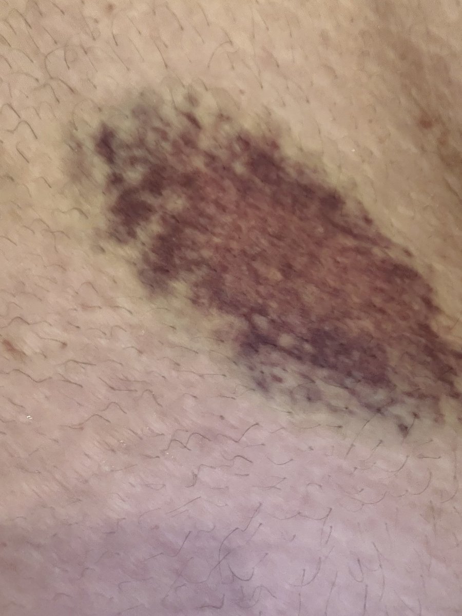 MarkyNextDoor tweet media