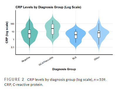 HeadacheJournal's tweet image. Open Access:
Myth: Headache → order ANA test
Fact: Most positive ANA results aren’t linked to autoimmune disease
A new study highlights the risks of overtesting.
Manuscript link: …adachejournal.onlinelibrary.wiley.com/share/NVKFGH8G…
@nicmaggio et al
#Headache #Neurology