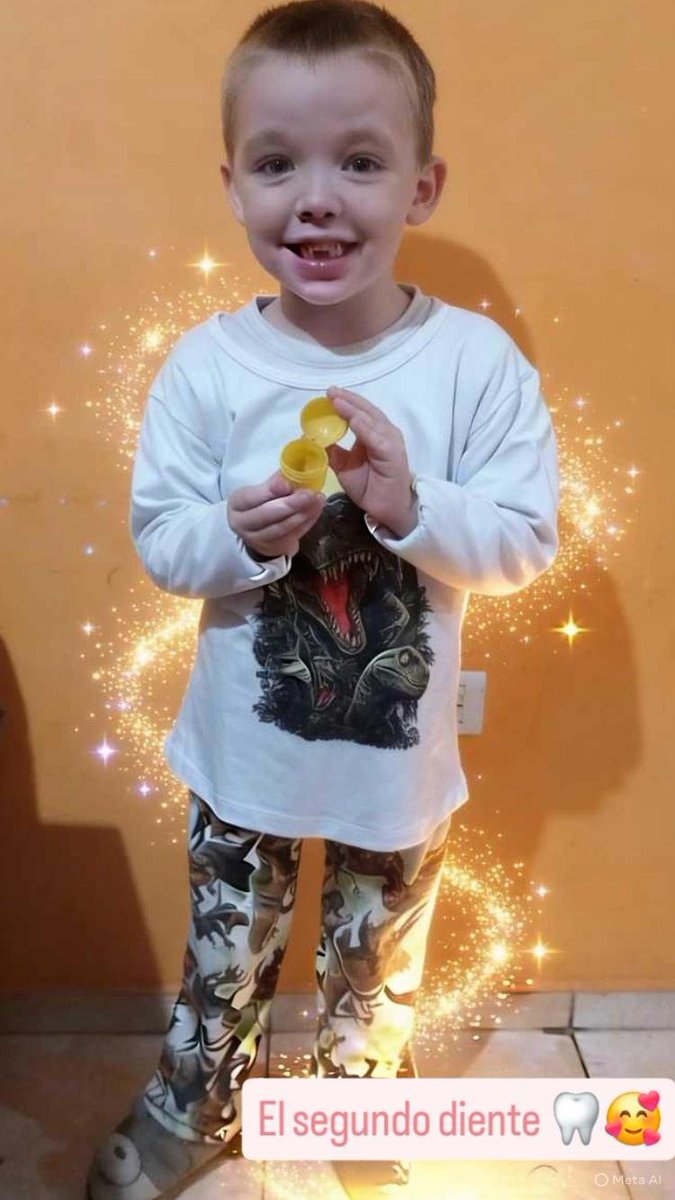 Segundo 🦷🥰✨️🐭