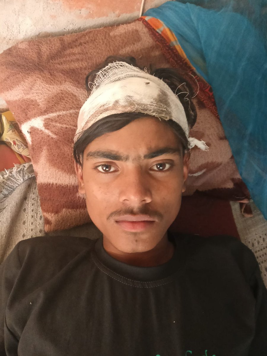 Sonuncl's tweet photo. थाना ठूठीबारी क्षेत्र अंतर्गत ग्राम जमुई कला में एक मनबढ़ व्यक्ति ने किया नाबालिक बच्चे के ऊपर जान लेवा हमला महोदय संज्ञान लेते हुए स्थानीय थाने को FIR दर्ज करने के लिए आदेशित करने की कृपा करें।
@maharajganjpol
@Uppolice @DmMaharajganj @dgpup @myogiadityanath @UPGovt https://t.co/EabM10P5lc