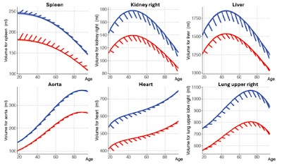 Radiology_AI's tweet image. A retrospective study of 127,114 patients establishes reference charts for CT-derived, whole-body anatomic volumes doi.org/10.1148/ryai.2… @AI_Medic #kidney #Liver #MachineLearning